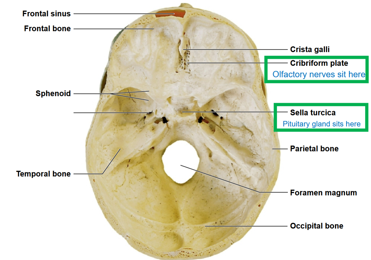 <p>What view of the skull is this, and what features <strong>SHOULD YOU KNOW?</strong></p>