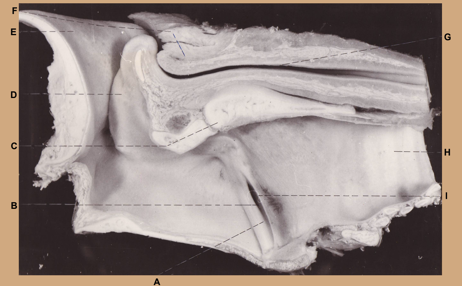 <p>A &amp; I</p><p>(pig larynx median section)</p>