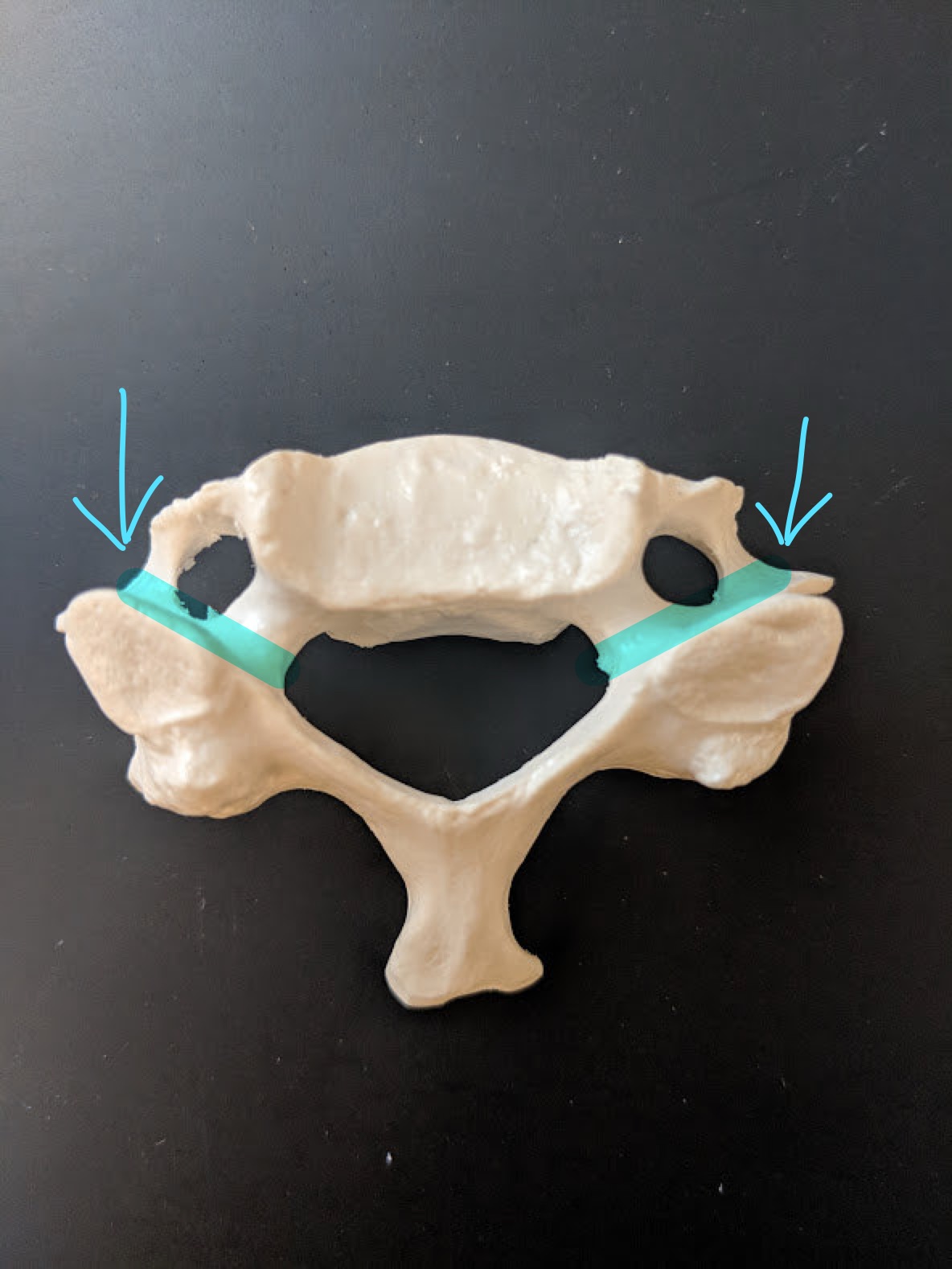 <p>Name this structure</p>