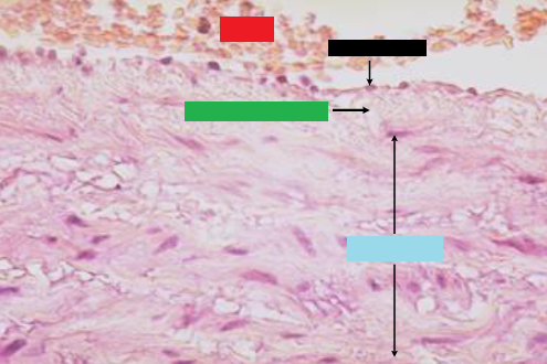 The tunica intima of aorta is lined by endothelium (simple squamous epithelium) underneath which is (GREEN)