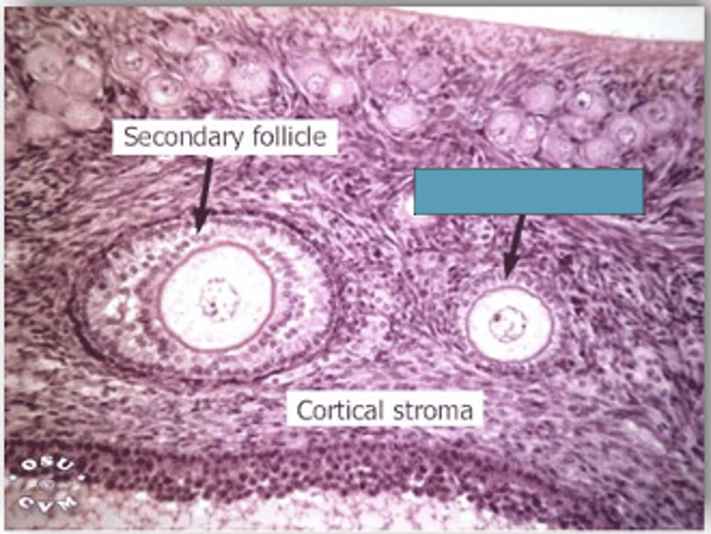 <p>Identify the stage of the follicle</p>
