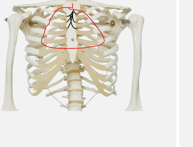 <p>what type of joint is this</p>