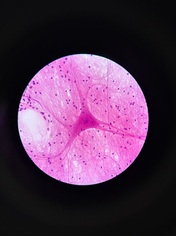 <ul><li><p>Neurons = bigger blobs w/tentacle-like arms </p></li><li><p>Glial cells = small little “dots”</p></li><li><p>Axons = transmits signal away from neuron</p></li><li><p>Dendrites = receives signals toward the cell</p></li></ul><p><em> Impossible to tell which of the arms are axons or dendrites without context</em></p><p></p>