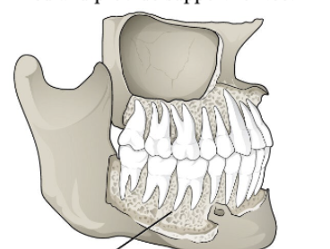 <p>Gomphoses</p>