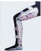 <p><strong>Total surface bearing/thermoplastic orthosis</strong></p><p><strong>Advantages:</strong></p><ul><li><p>Increases control</p></li><li><p>Reduces pressure on the skin</p></li><li><p>More comfort</p></li><li><p>Considerably lighter</p></li><li><p>High durability</p></li><li><p>Easy to clean/hygienic</p></li><li><p>Can be used easily with different shoes</p></li></ul><p><strong>Disadvantages:</strong></p><ul><li><p>Does not accommodate changes in volume</p></li></ul><p></p>
