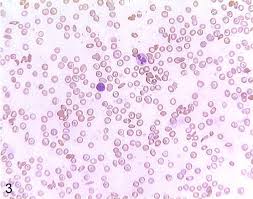 <p>Blood Tissue — Function</p>