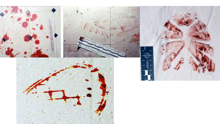 <p>what type of bloodstain patterns are these?</p>