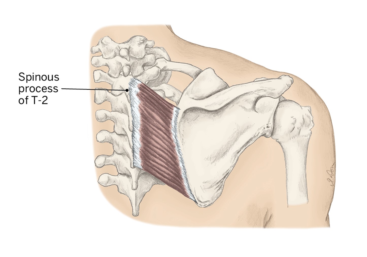<p>O- Spinous processes (C7-T5)</p><p>I- Medial Border of the scapula</p><p>A- Scapula retraction &amp; elevation</p><p></p>