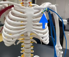 <p>Name the blood vessel.</p>