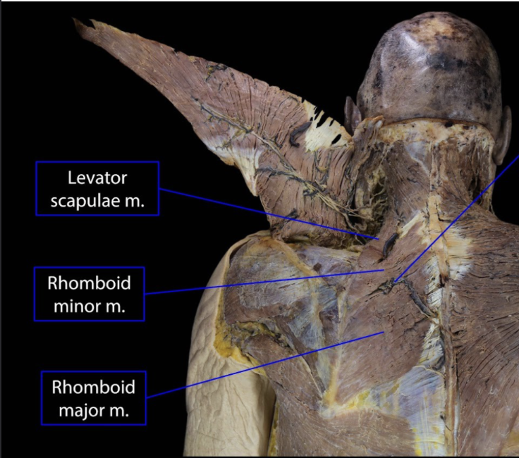 <p>Levator scapulae</p><p>Rhomboid minor</p><p>Rhomboid major</p>