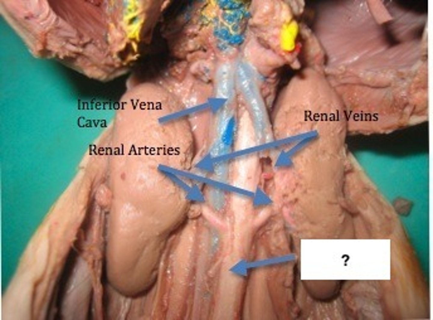 <p>Abdominal aorta</p>