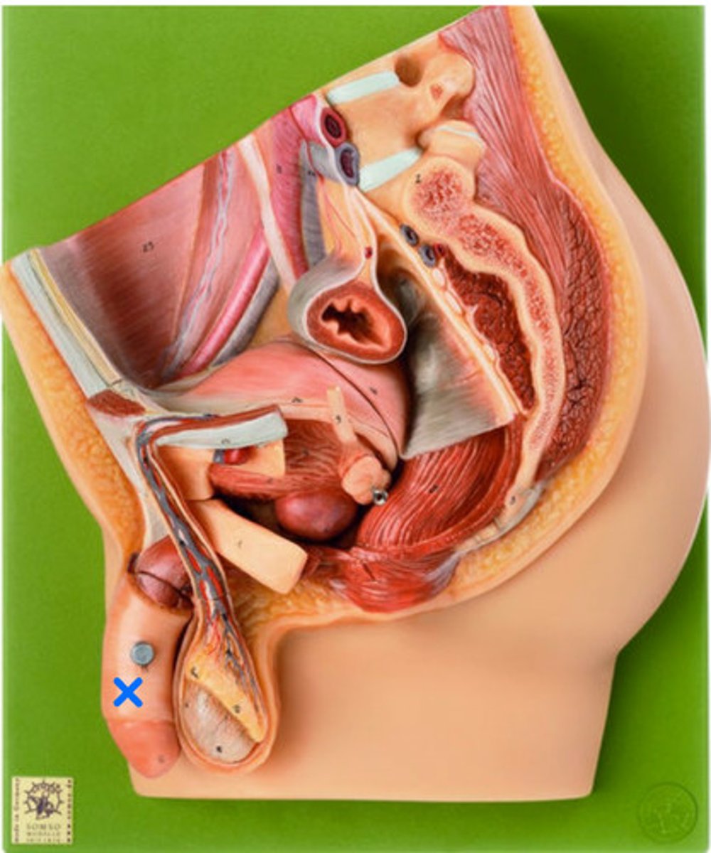 <p>ID Organ Marked with the Blue X</p>