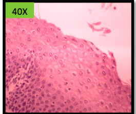 * can have a layer of keratin 
* protection against abrasion i.e. eating having multiple layers is beneficial 
* (SKIN, ESOPHAGUS)