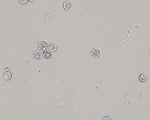 <p><span style="font-family: MyriadPro-Light;">Glitter cells (</span><span style="font-family: Symbol;">×</span><span style="font-family: MyriadPro-Light;">400)</span></p>