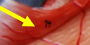 <p>Arrector Pili Muscle</p>