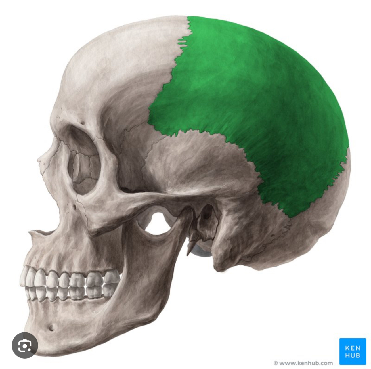 <p>ROOF OF SKULL</p><p>Two large flat bones that form top sides of the skull</p><p></p><p></p><p></p>