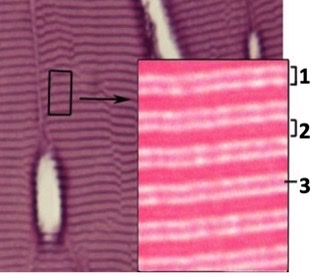 name these structures in skeletal muscle