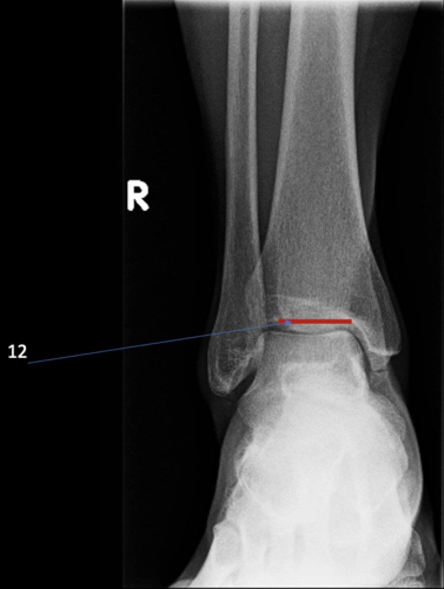<p>ID 12</p>