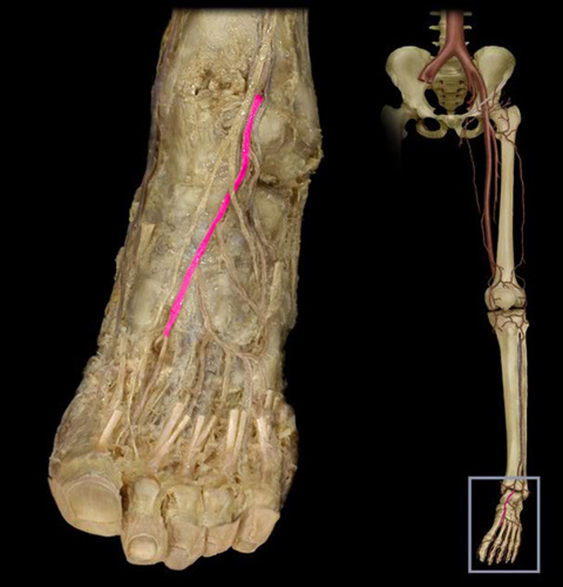 <p>The continuation of anterior tibial artery, supplies the forefoot. Under the extensor hallucis longus.</p>