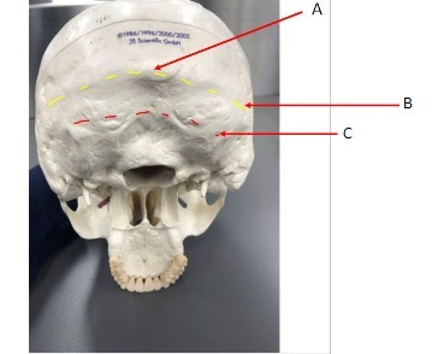 <p>What category of bone is it? What bone is it? Label the structures.</p>
