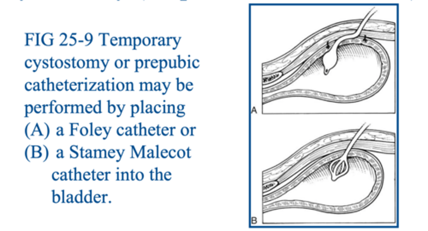 <p>what procedure is shown here</p>