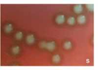 <p><span style="font-family: Calibri, sans-serif">Smooth colonies</span></p><p><span style="font-family: Calibri, sans-serif">Virulent</span></p><p><span style="font-family: Calibri, sans-serif">Have a capsule that allows them to evade the immune system</span></p>