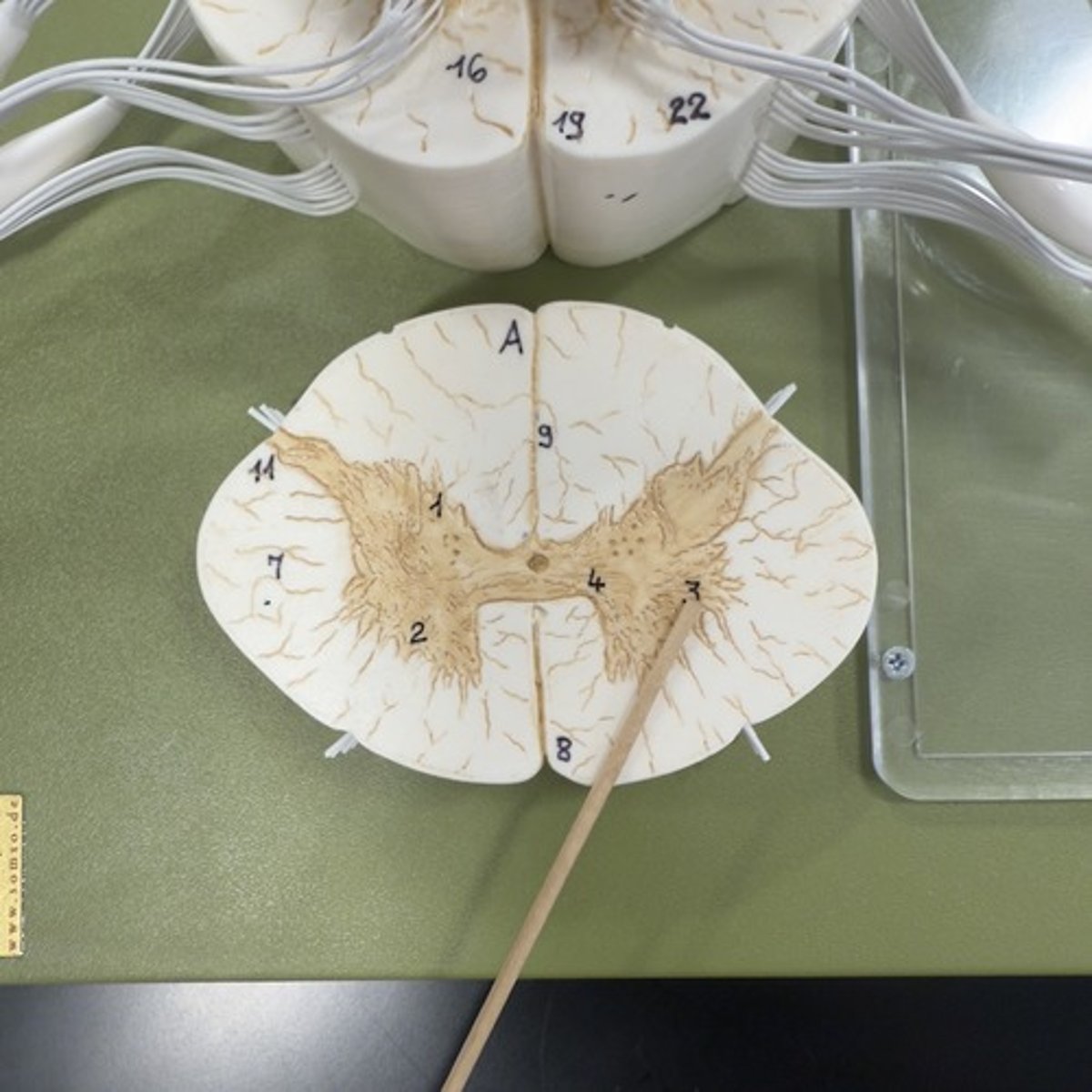 <p>Identify the structure.</p>