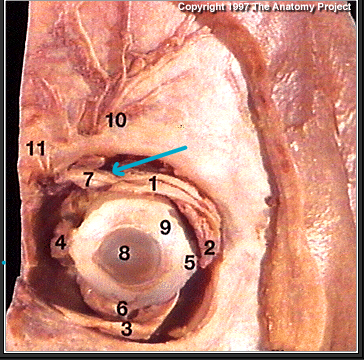 <p>what muscle?(#7)</p>