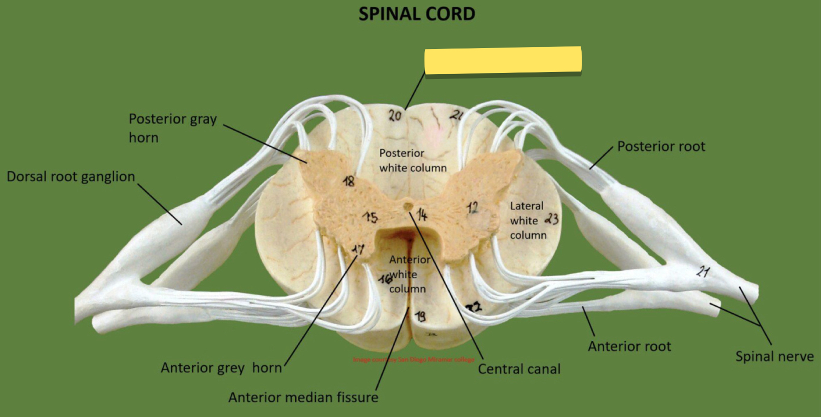 <p>Name this spinal cord part</p>