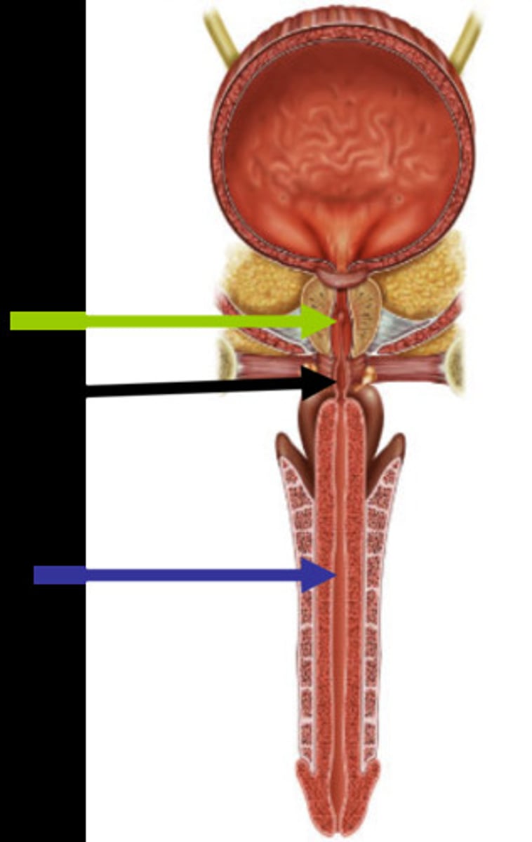 <p>What part of the bladder and urine transport is this?</p>