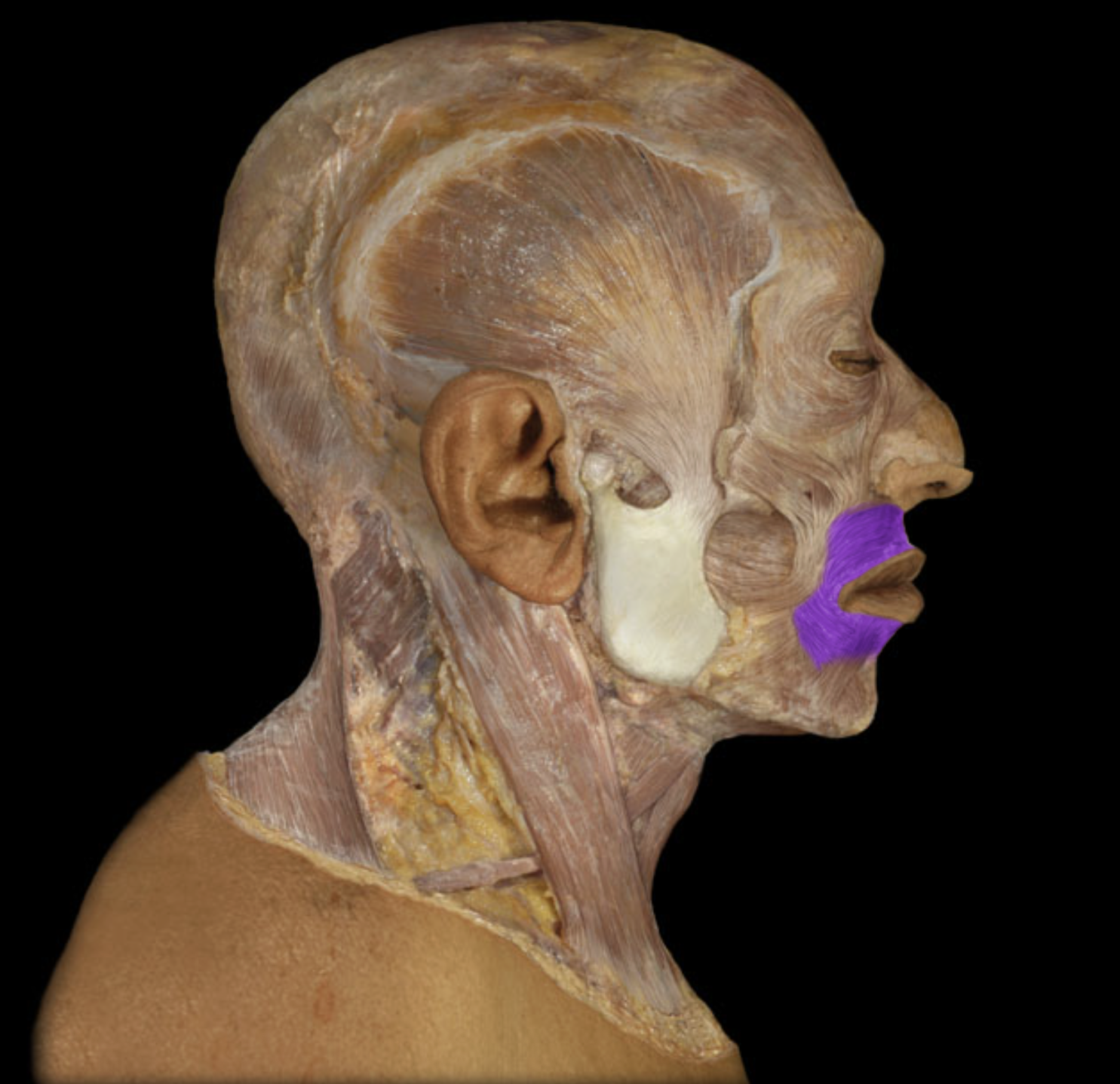 <p>What muscle is this?</p>