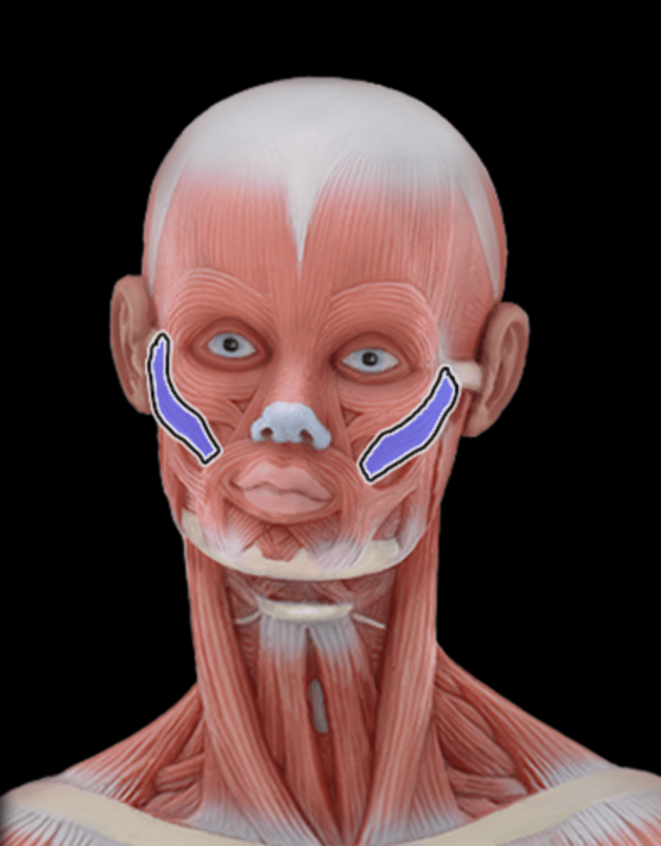 <p>What Muscle Is Highlighted?</p>