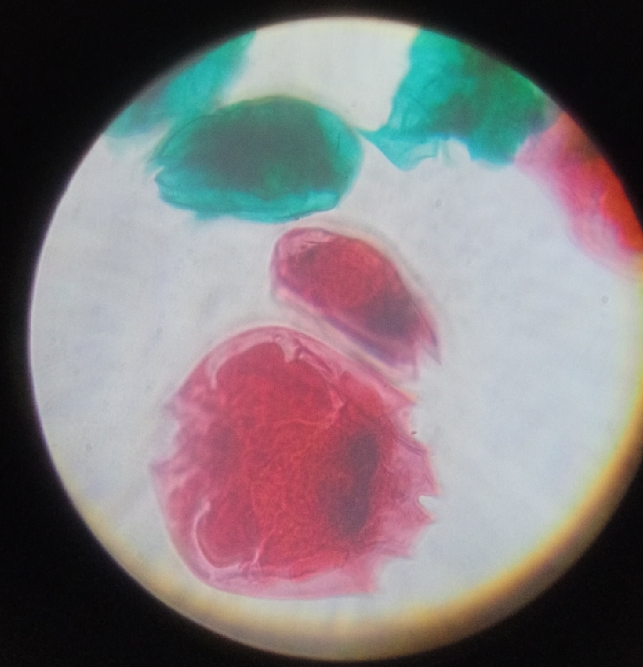 <p>Its name comes from Latin radius meaning “ray” and the suffix -aria denoting connection or possession, referring to the organism’s radial symmetry and spiny, ray-like silica skeleton. This etymology reflects ______ intricate, starburst-like morphology, which aids in buoyancy and feeding in marine planktonic environments.</p>