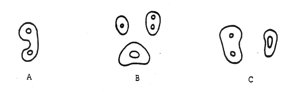 <p>which of these cervical views in the mid-root section of #14?</p>