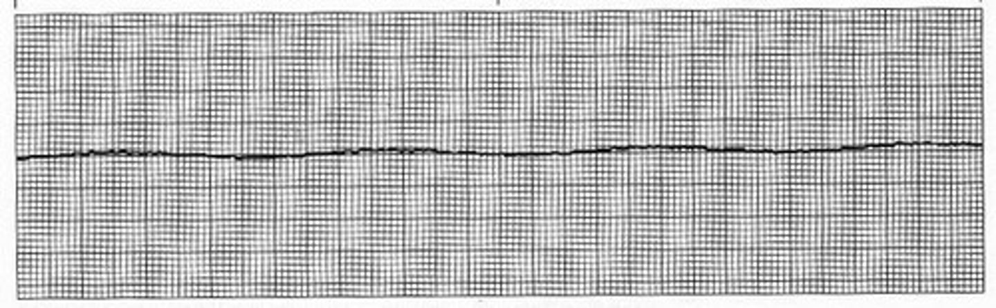 <p>CPR</p><p>epinephrine</p><p>checks for shockable rhythm q 2 mins</p>