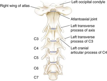 <p>Cervical</p>