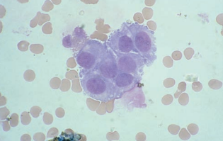 Figure 14: Choroidal cells