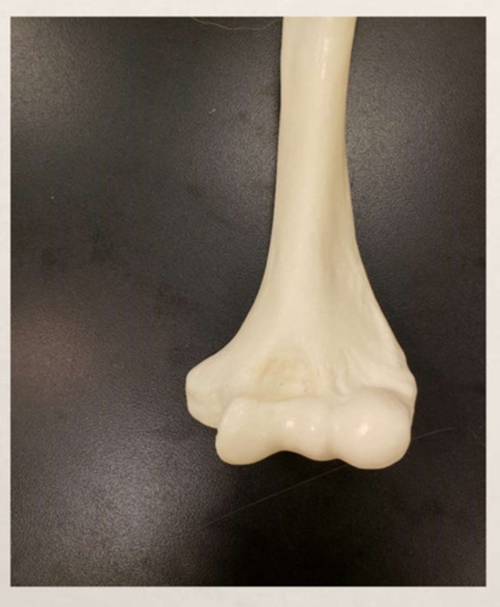 <p>anterior/posterior view of proximal/distal humerus?</p>