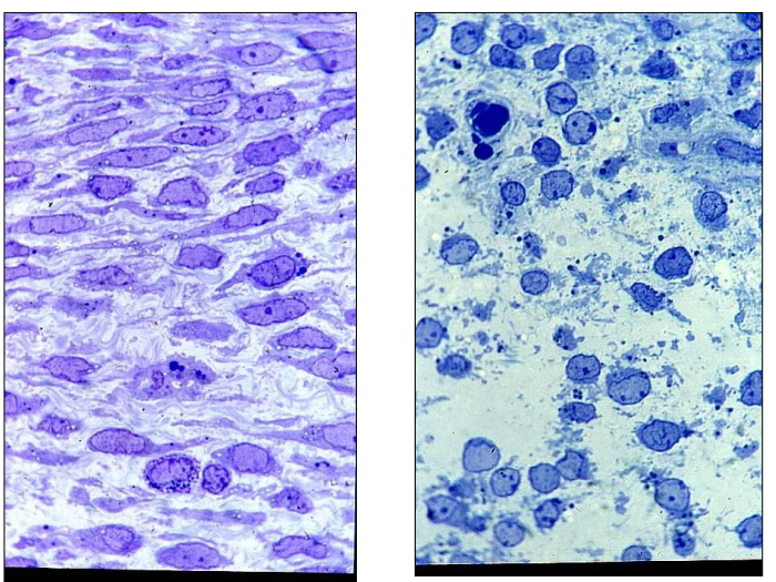 <p>Where is this epithelium</p>