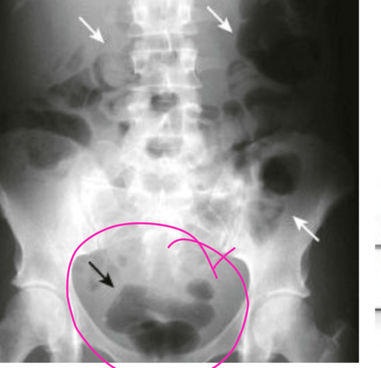 <p>the pink circle is indicating what, what view was this likely taken at</p>