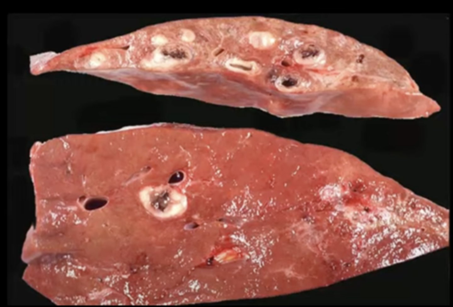 <p>What has caused this gross appearance of this cow liver?</p>