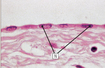 <p>what type of epithelium is shown here</p>