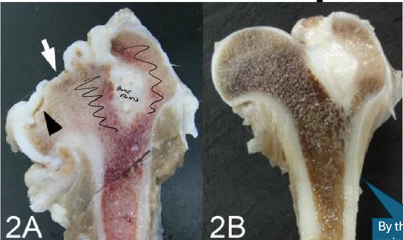 <p>Indicate what kind of bone marrow this is. Describe 2A and 2B.</p>