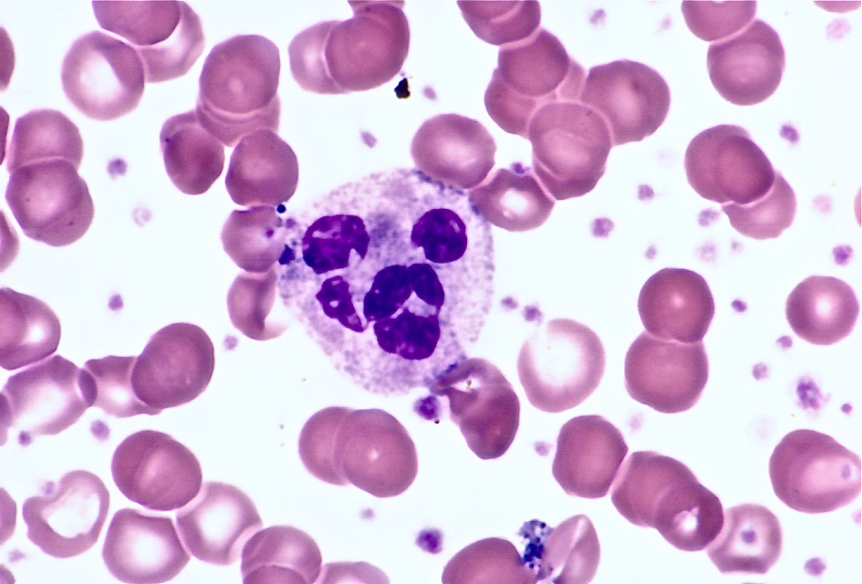 <p>The red blood cells here are representative of an anemia that is…</p>
