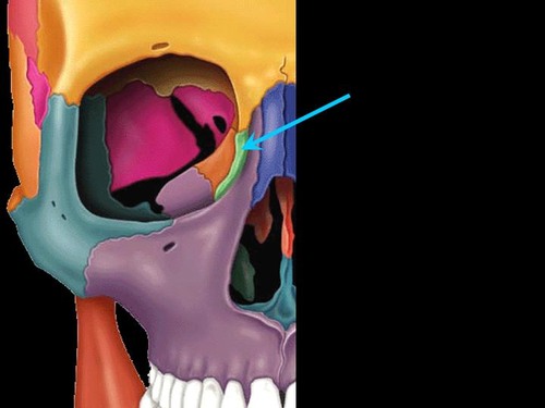 <p>small fragile bone making up part of the front inner walls of each eye socket and providing room for the passage of the lacrimal ducts</p>