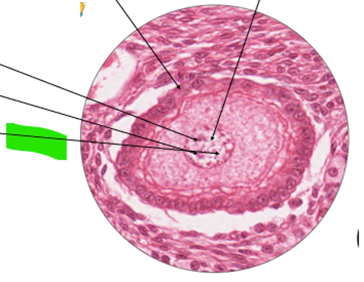 <p>part of tertiary follicle?</p>