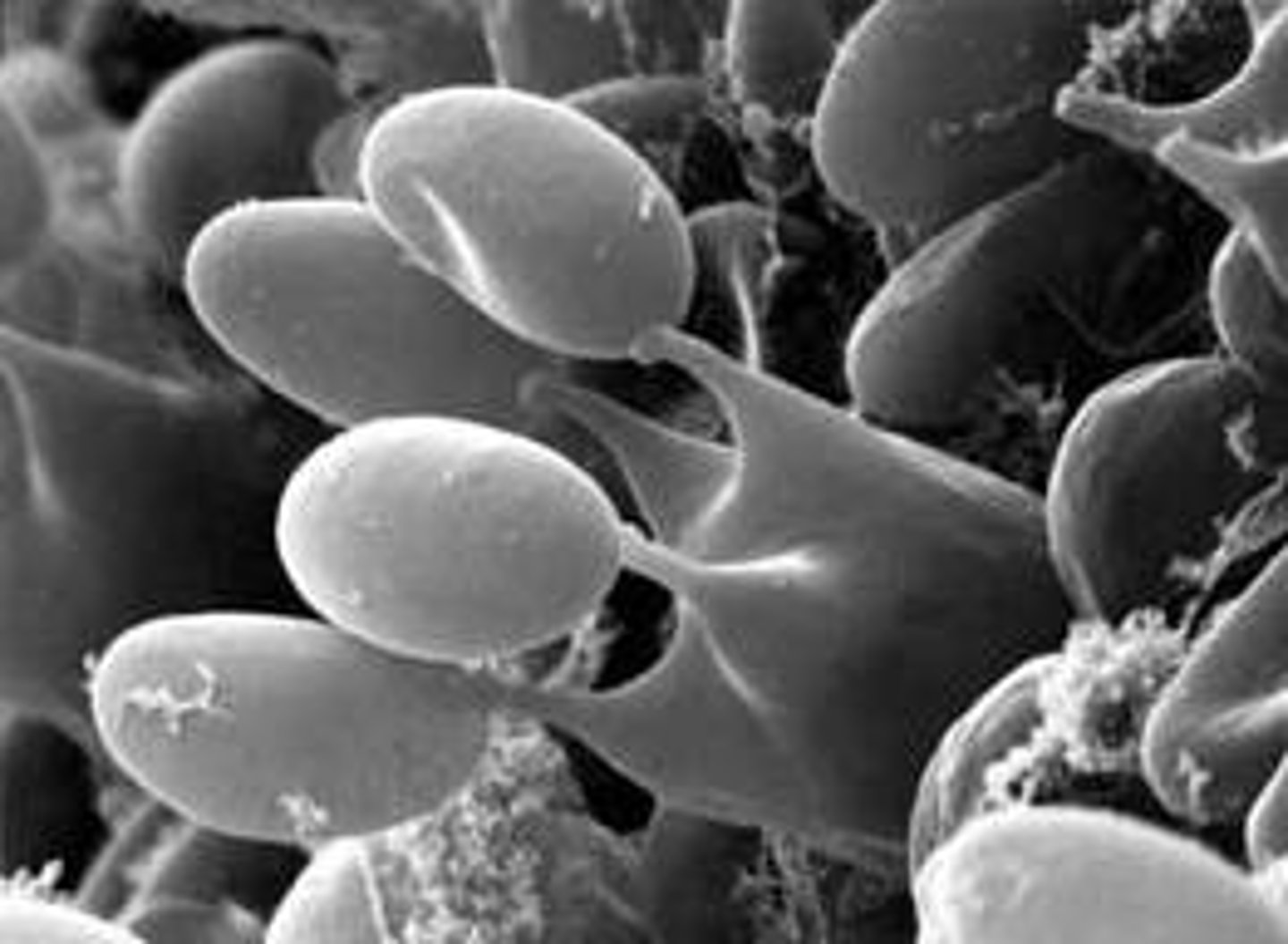 <p>4 tiny stalks bearing basidiospore on basidium</p>