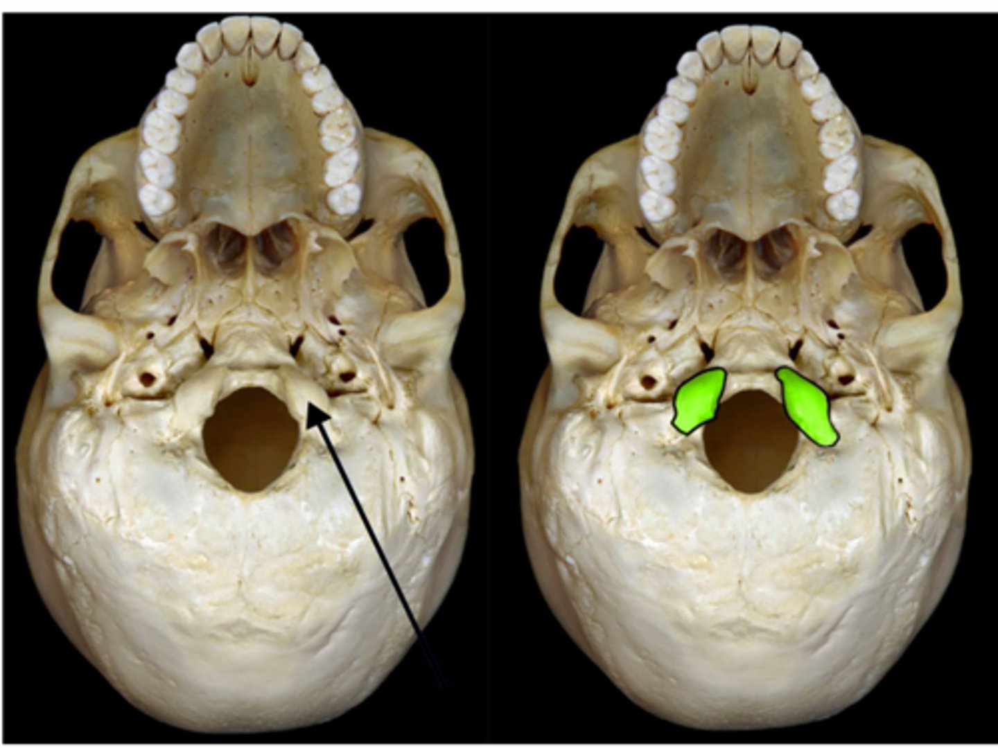 <p>paired rounded process lateral to the foramen magnum</p>