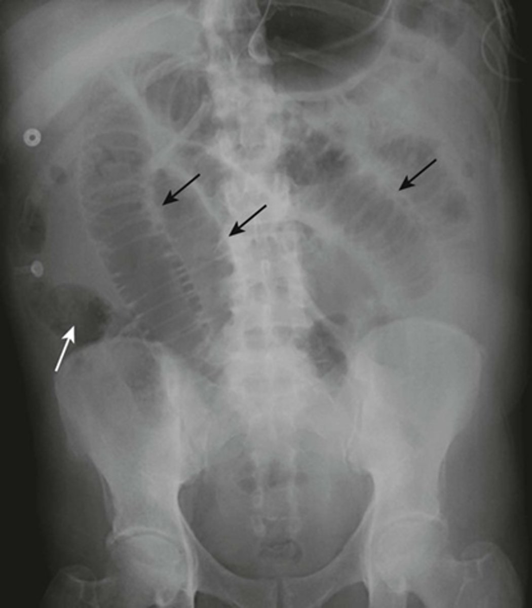 knowt flashcard image