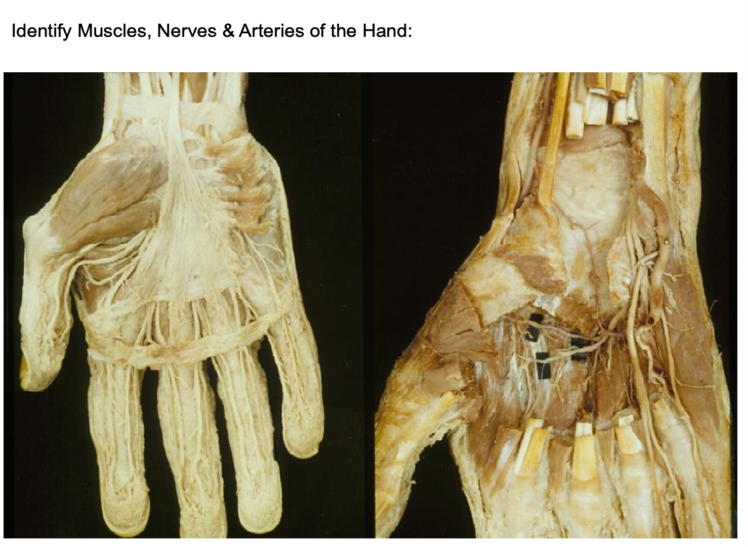 <p><span>What structures are the yellowish bundles visible in the palm?</span></p>